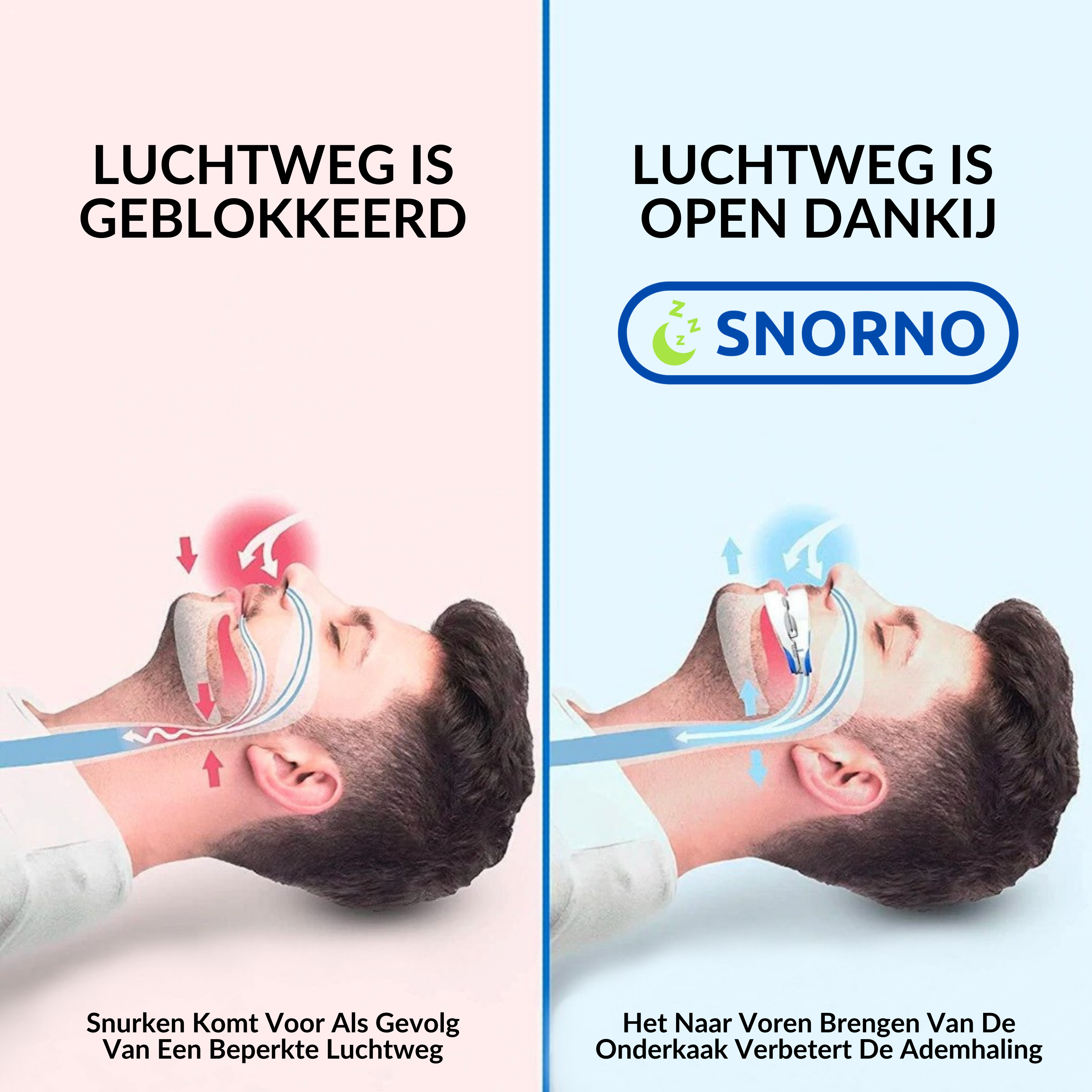 Anti-Snurk Beugel | Gebruiksvriendelijk & premium comfort - DueSnor