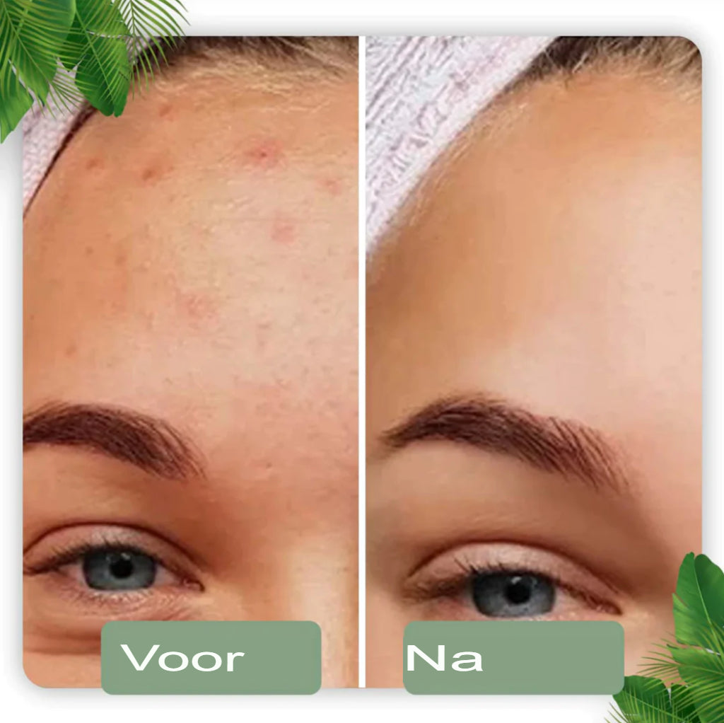 SkinMask - Reinigingsmasker met groene thee-extract als stick - dieptereiniging, verwijdert mee-eters