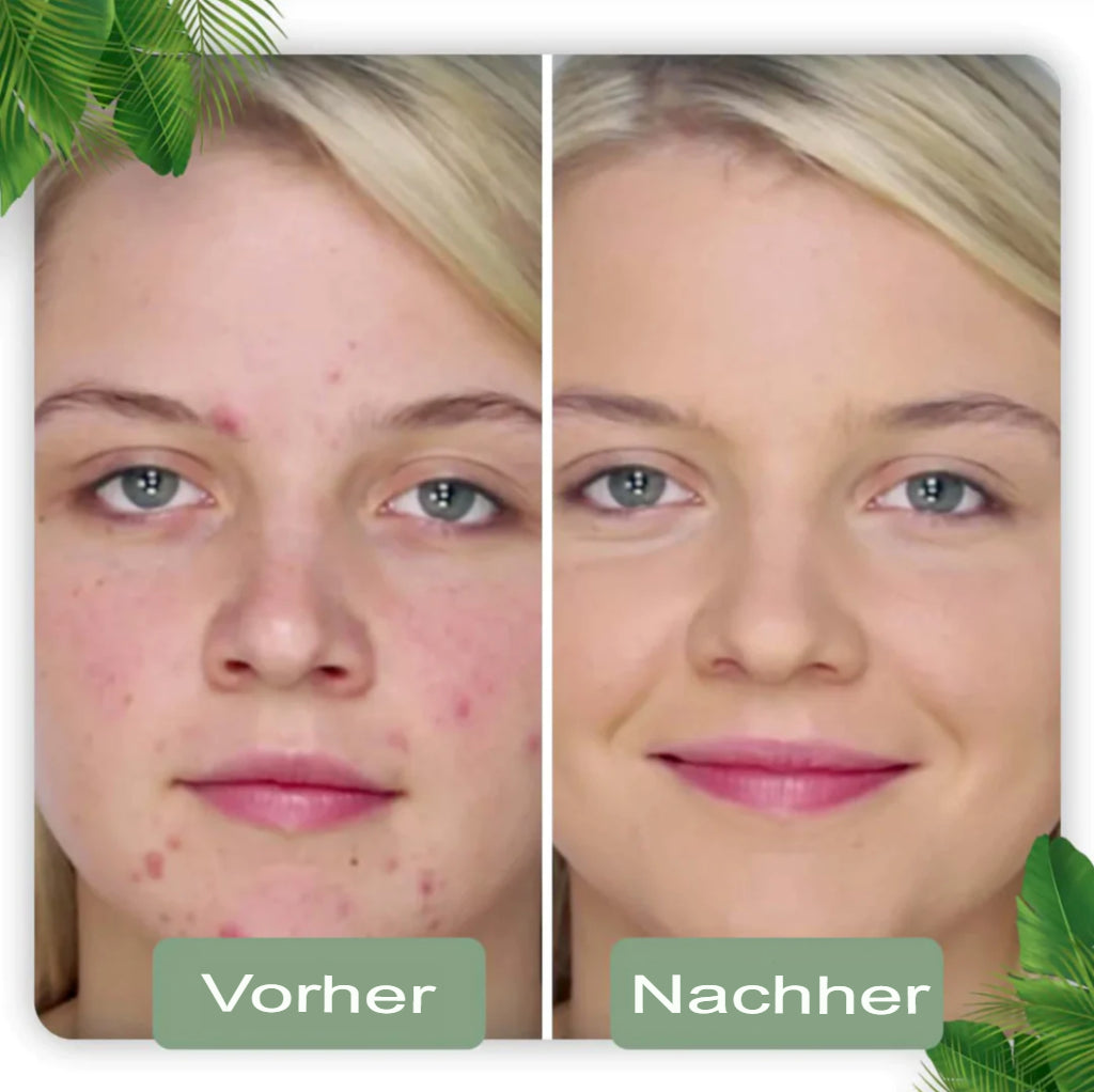 SkinMask - Reinigingsmasker met groene thee-extract als stick - dieptereiniging, verwijdert mee-eters