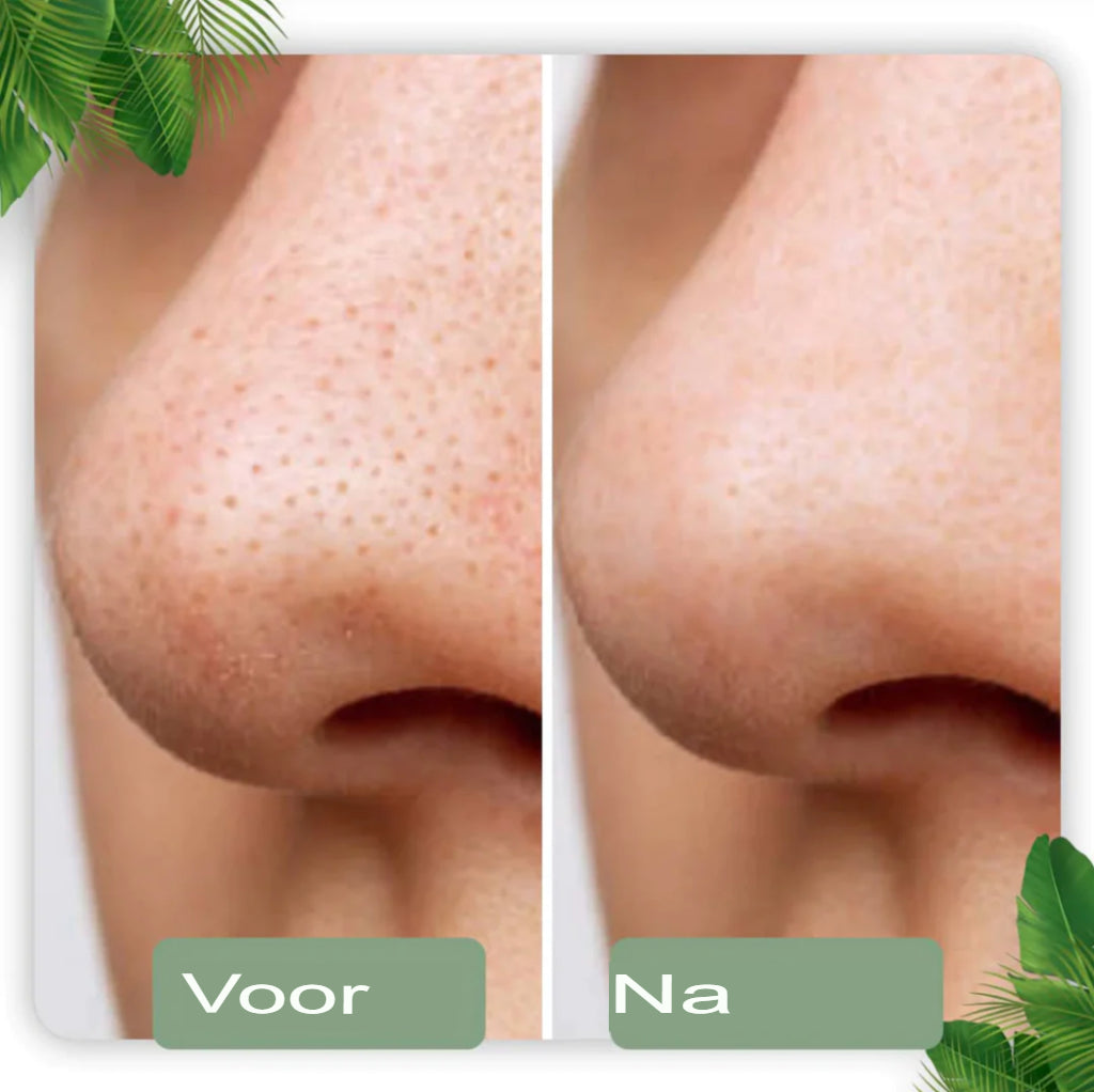 SkinMask - Reinigingsmasker met groene thee-extract als stick - dieptereiniging, verwijdert mee-eters