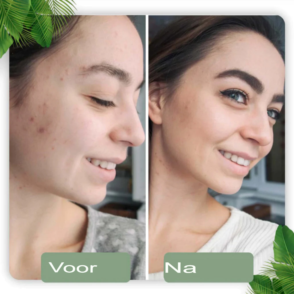 SkinMask - Reinigingsmasker met groene thee-extract als stick - dieptereiniging, verwijdert mee-eters