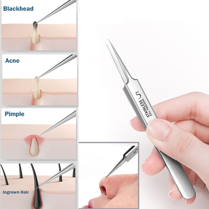 Professionele Blackhead Pincet - Twenless