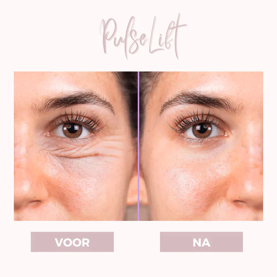 EyePat - Dermatologisch oogliftapparaat