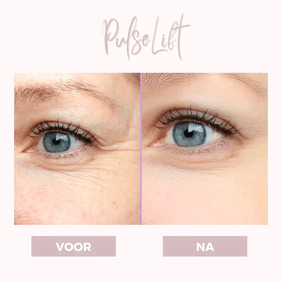 EyePat - Dermatologisch oogliftapparaat