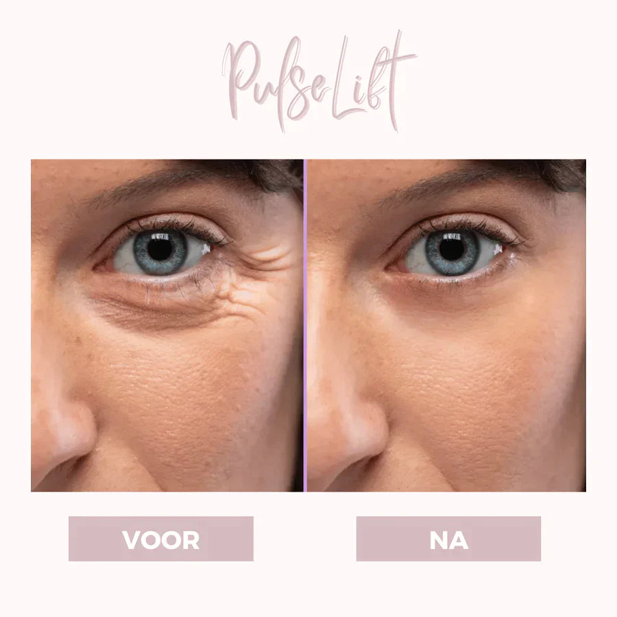 EyePat - Dermatologisch oogliftapparaat