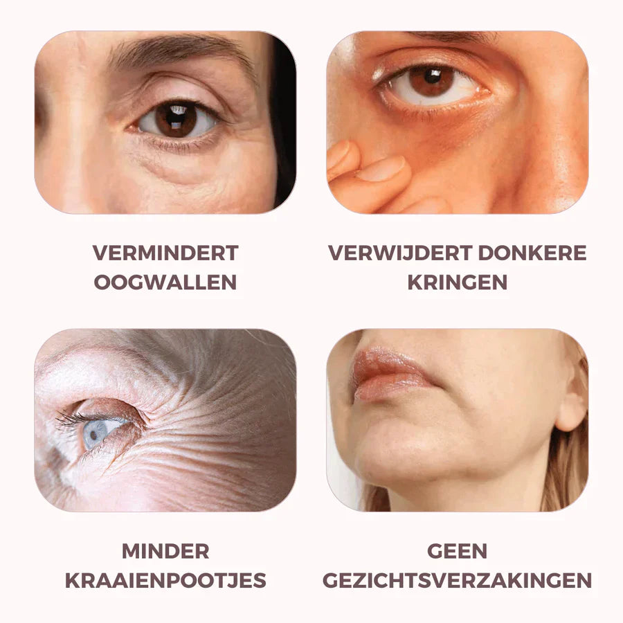 EyePat - Dermatologisch oogliftapparaat